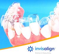 みやのデンタルオフィスが選ばれる理由02